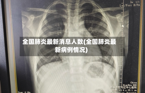 全国肺炎最新消息人数(全国肺炎最新病例情况)