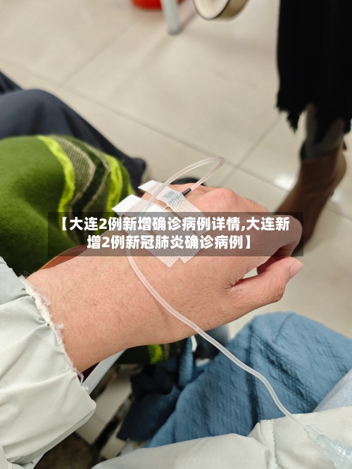 【大连2例新增确诊病例详情,大连新增2例新冠肺炎确诊病例】