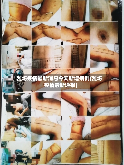 潍坊疫情最新消息今天新增病例(潍坊疫情最新通报)